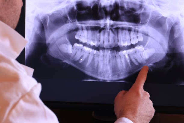 Best Emergency Broken Tooth Repair in Monticello, UT