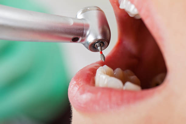 Best Emergency Treatment for Toothache in Monticello, UT
